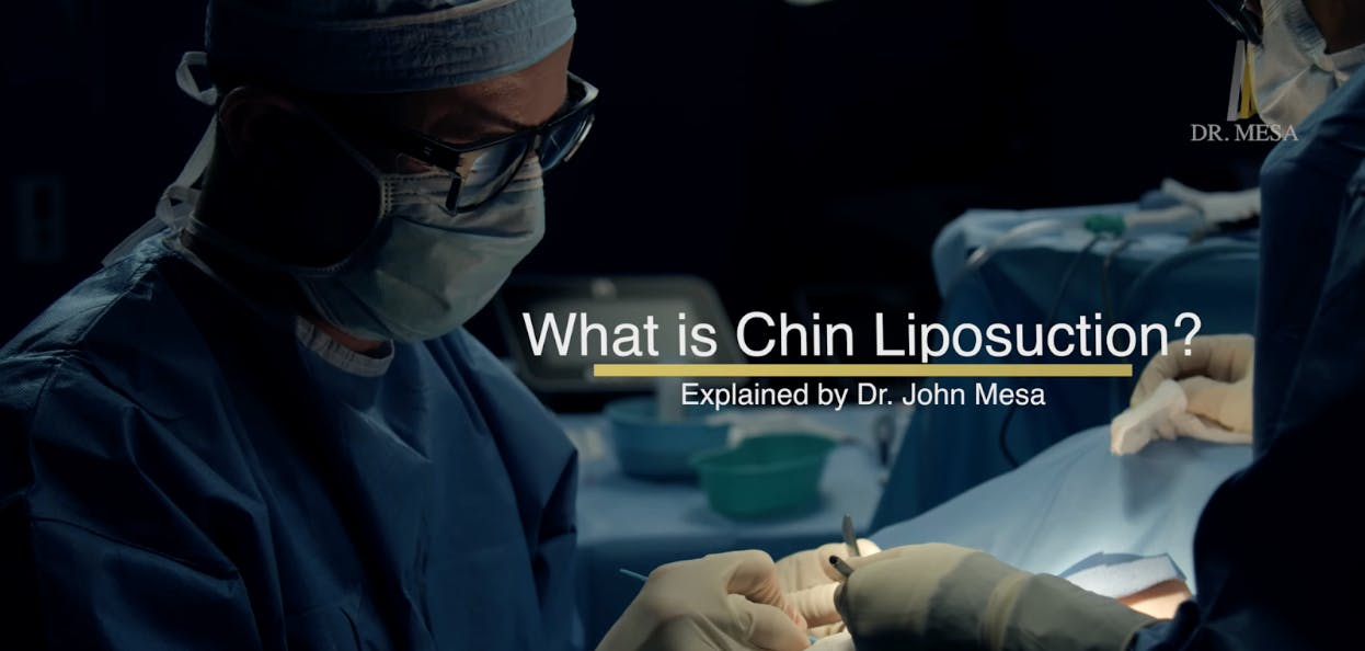 Do You Need to Wear a Compression Garment After Chin Liposuction