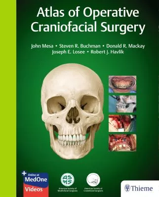 the cover of Atlas of Operative Craniofacial Surgery by Dr. Mesa