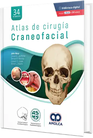 the cover of Atlas of Operative Craniofacial Surgery in Spanish