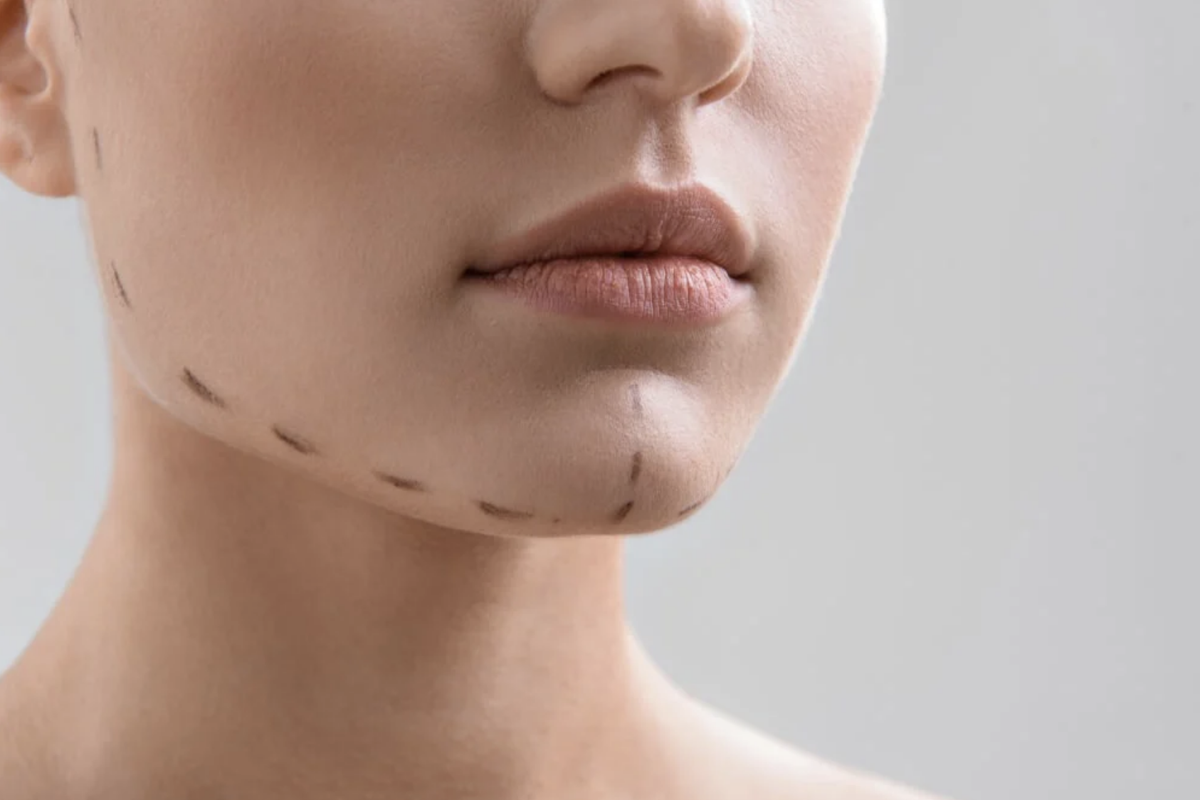 North Shore Cosmetic Surgery Blog | Picture Perfect: How Chin Plastic Surgery Can Balance Your Profile