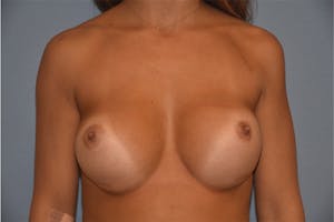 procedure