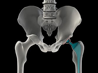 hip illustration with bones