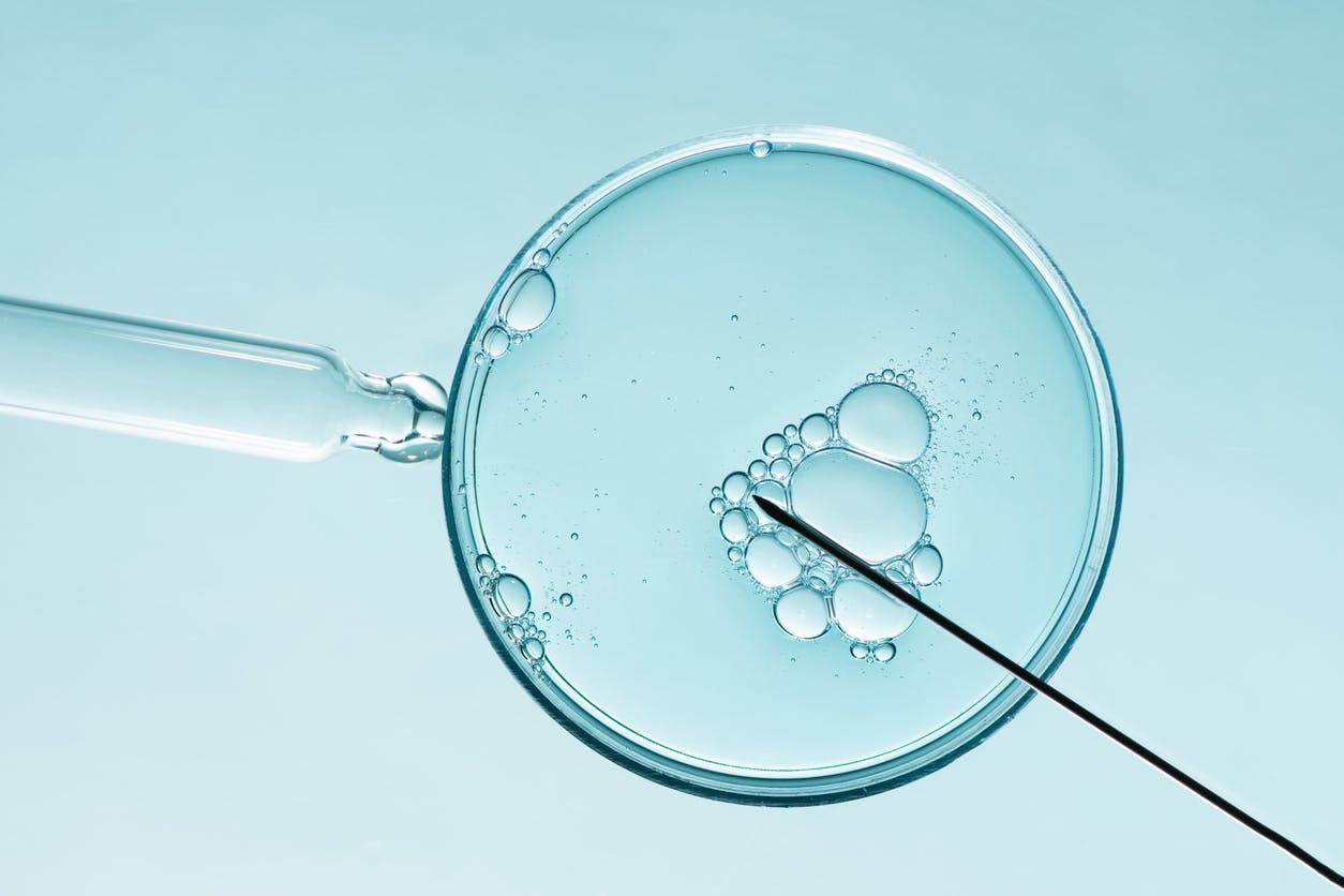 A photo of the IVF concept