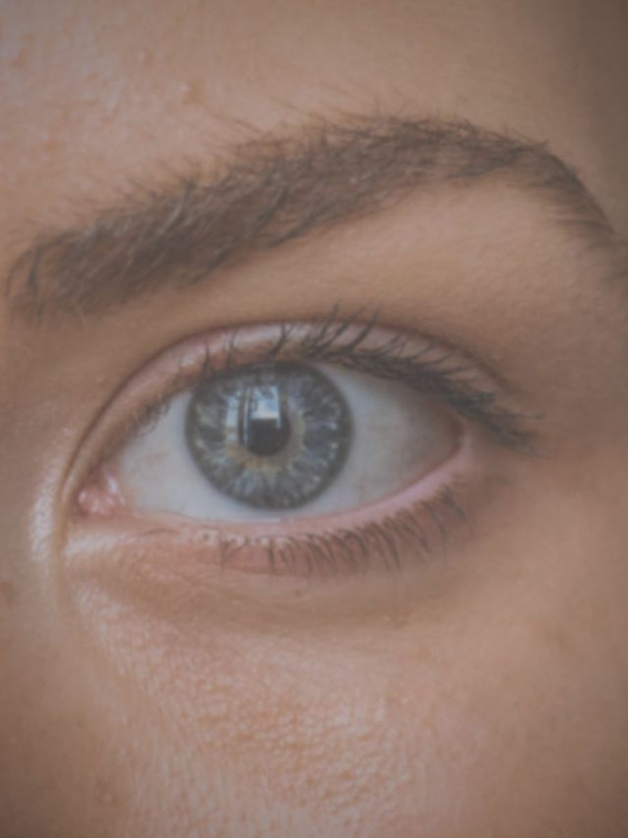 Blepharitis- Managing & Treating Blepharitis- Managing & Treating