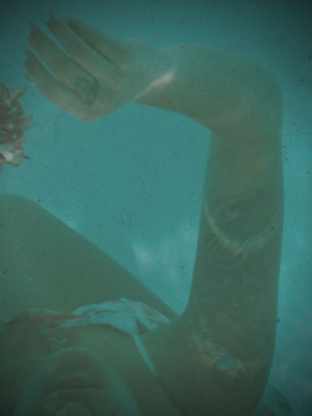 What Is Astigmatism? Symptoms, Causes & Treatment MTHK