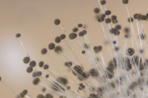 Image of fungal spores as seen through a microscope