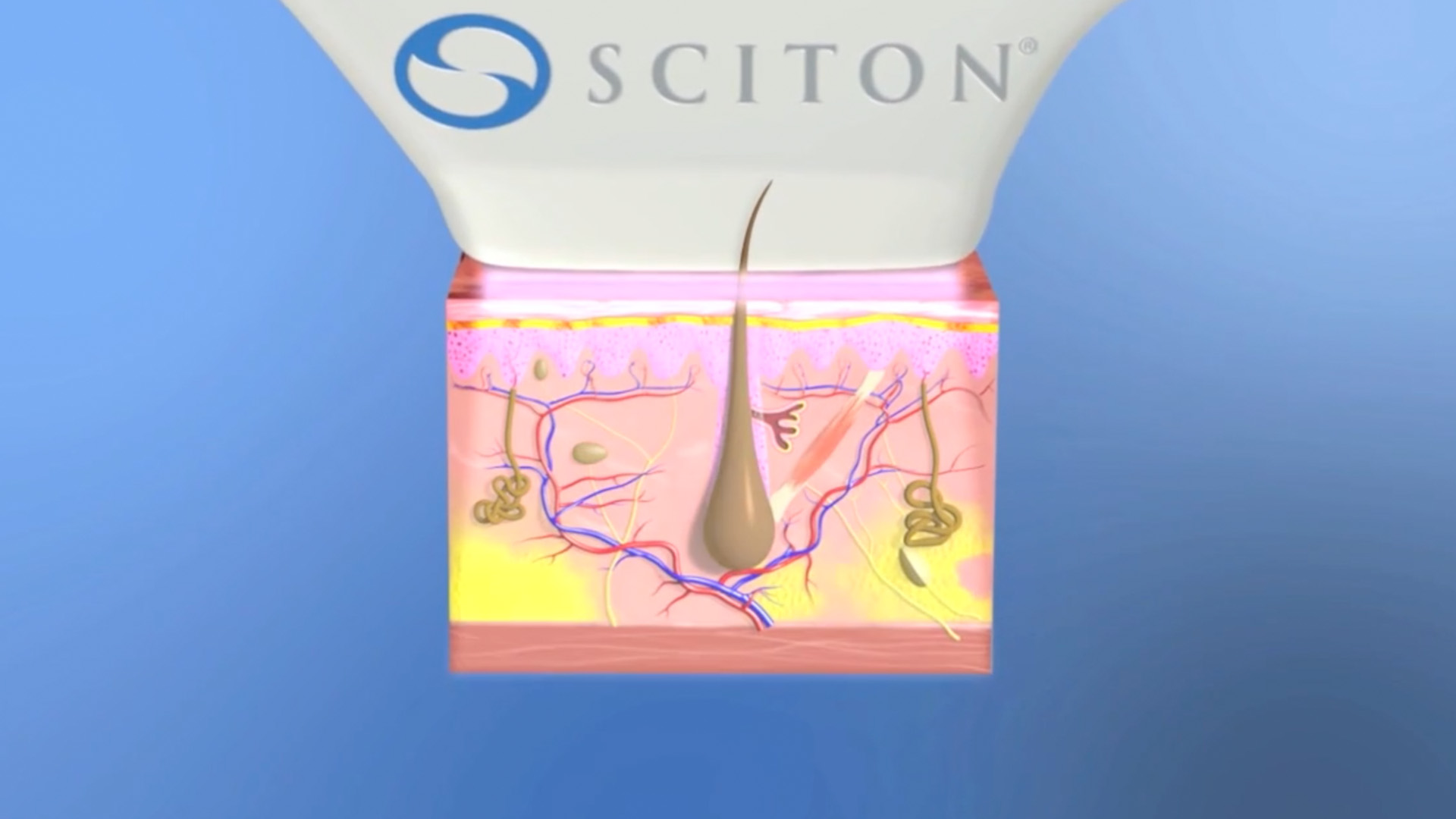 sciton machine animation