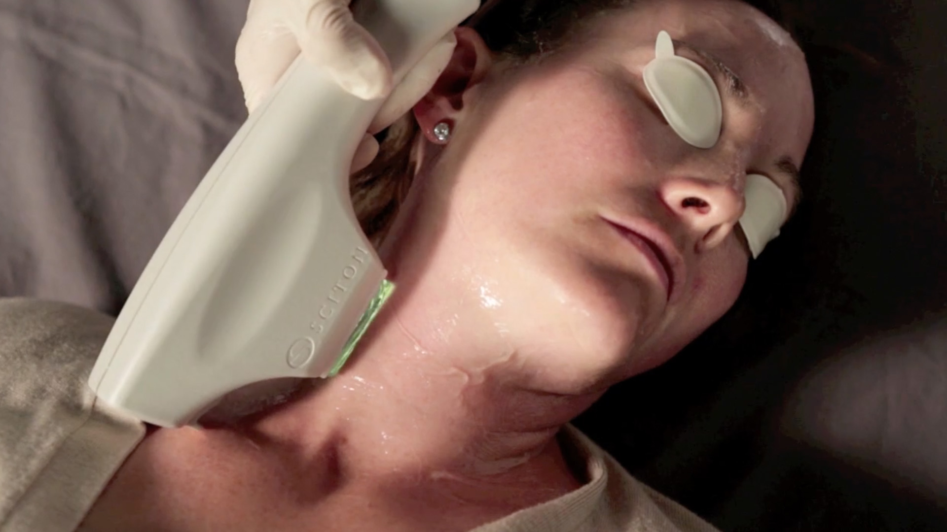 sciton machine being used on woman's face