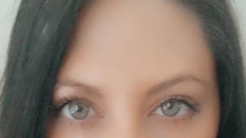 BOTOX, Dysport, Xeomin Before & After Gallery - Patient 32619603 - Image 2