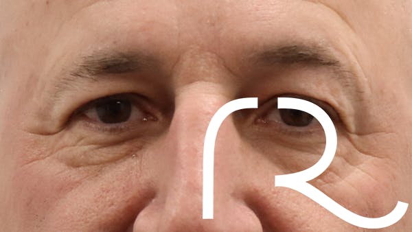 procedure