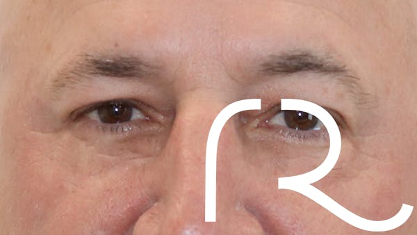 procedure