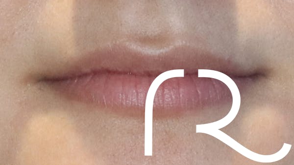 procedure