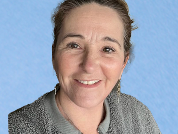 R2 Extended Deep Neck Lift Before & After Gallery - Patient 404188 - Image 6