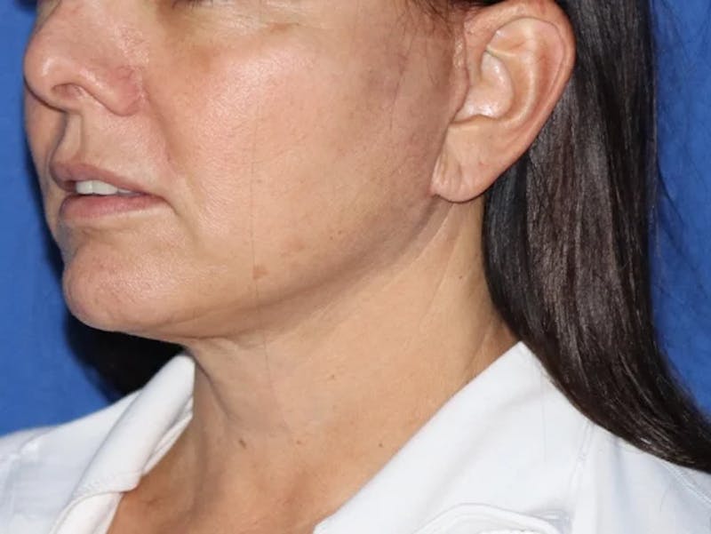 Rana Facial Plastic Surgery