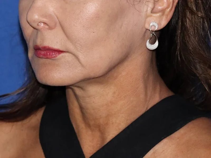 Rana Facial Plastic Surgery