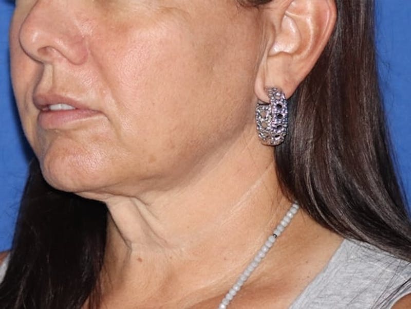 Rana Facial Plastic Surgery