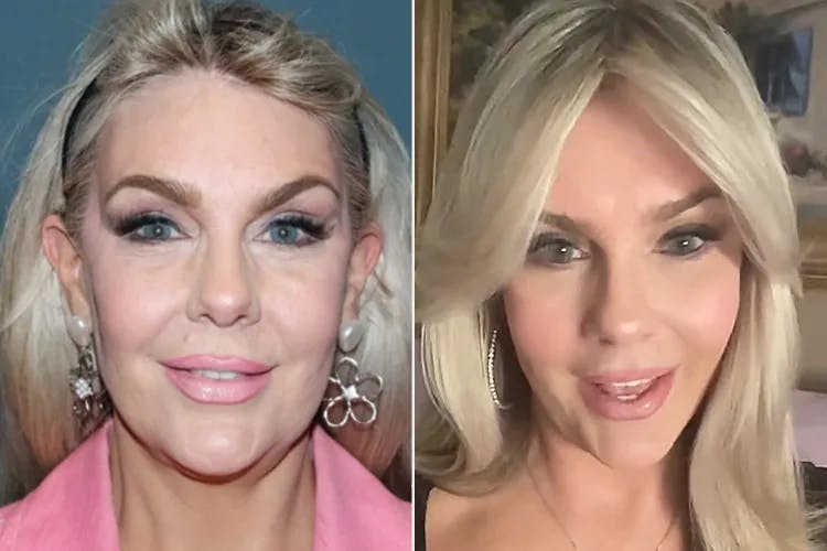 Dr. Rana Featured in People Magazine: Busting Myths About Cosmetic Surgery