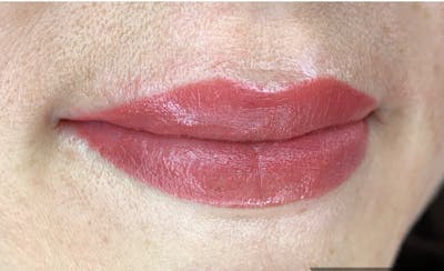Permanent makeup Before & After Gallery - Patient 10670338 - Image 2