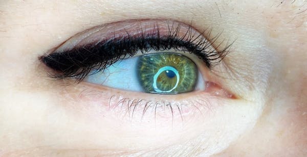 Permanent makeup Before & After Gallery - Patient 10670341 - Image 2