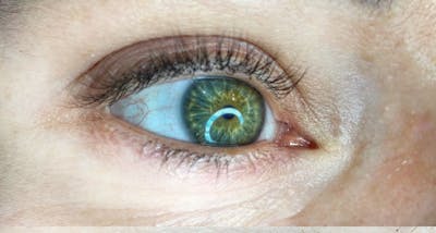 Permanent makeup Before & After Gallery - Patient 10670341 - Image 1