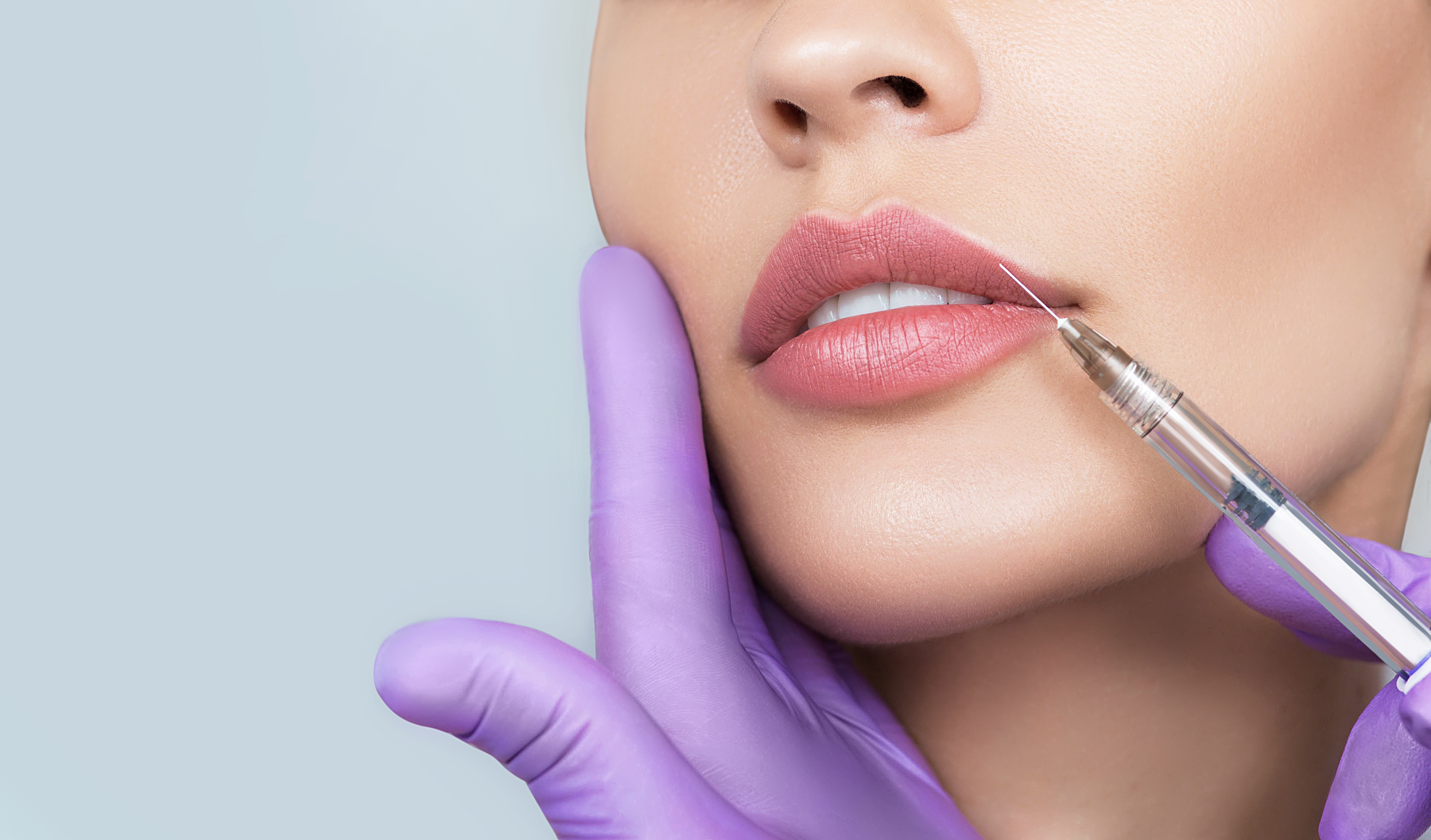 Juno Aesthetics Blog | Everything You Need to Know About the Russian Lip Filler Technique