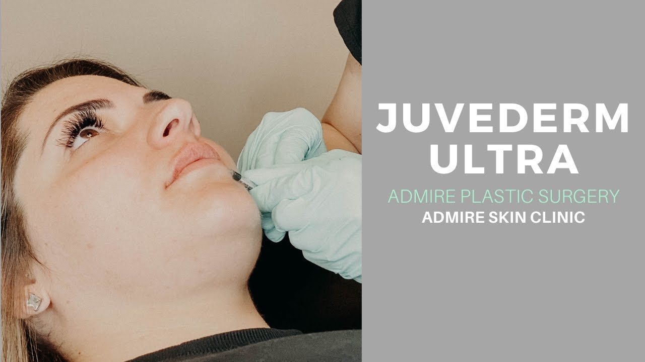 Juvederm video thumbnail