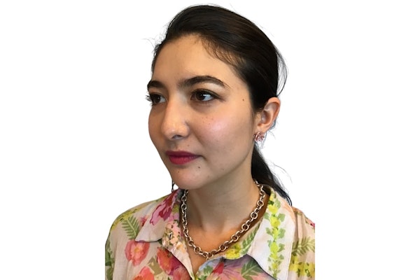 Rhinoplasty results in Scottsdale