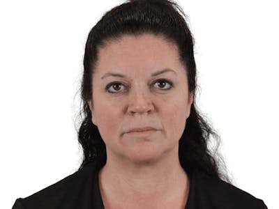 Facelift Before & After Gallery - Patient 113523474 - Image 1