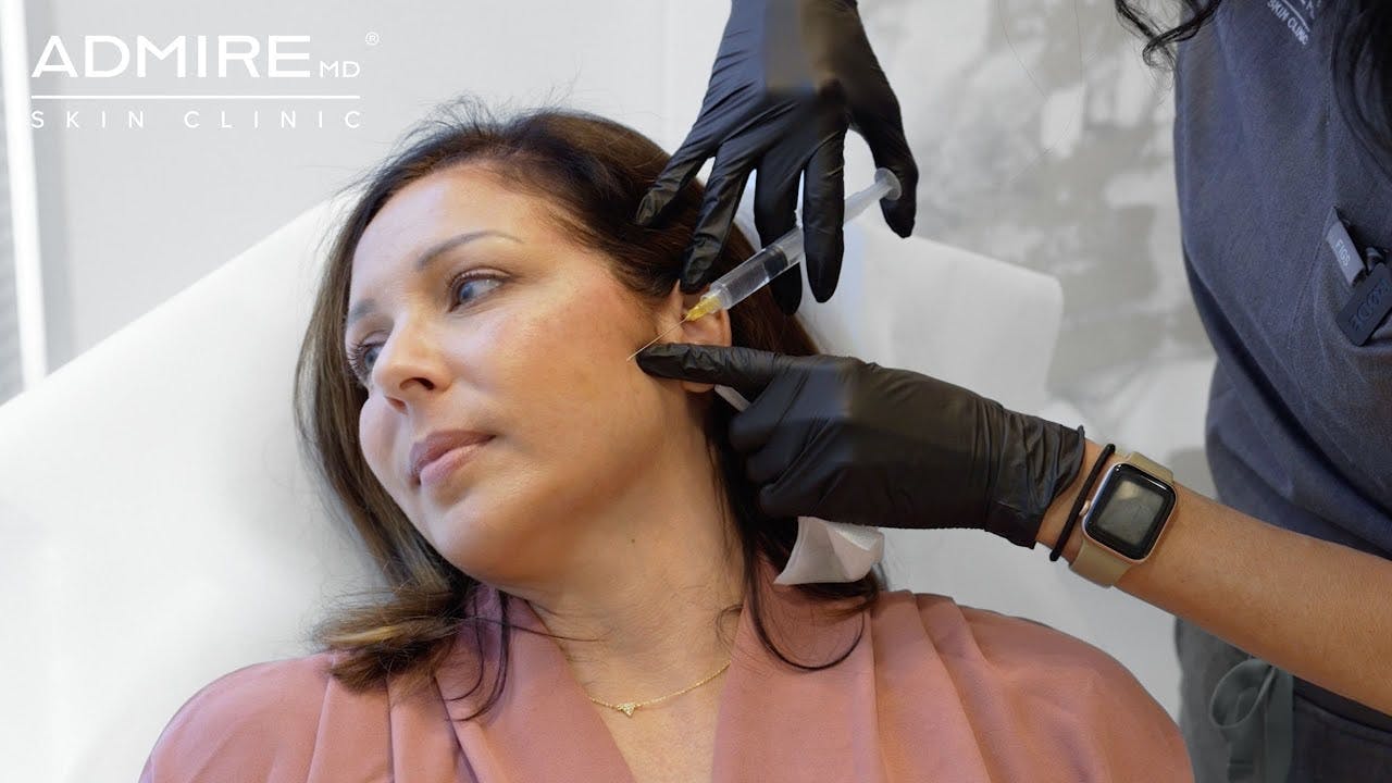 patient receiving sculptra