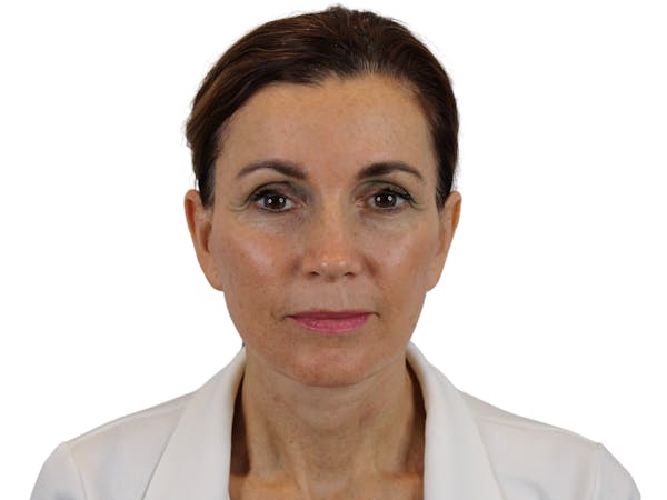AdmireMD Deep Plane Face & Neck Lift