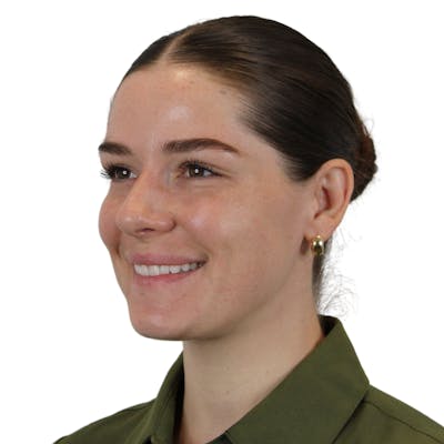 BOTOX  Before & After Gallery - Patient 400872 - Image 10