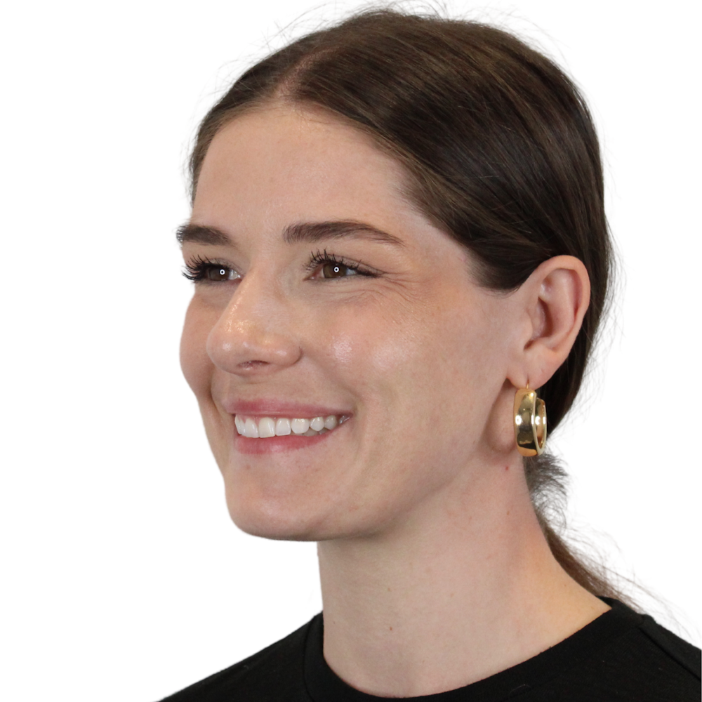 BOTOX  Before & After Gallery - Patient 400872 - Image 9