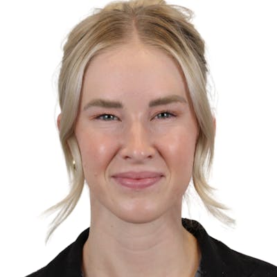 BOTOX  Before & After Gallery - Patient 334311 - Image 6