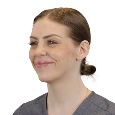 BOTOX  Before & After Gallery - Patient 240504 - Image 6
