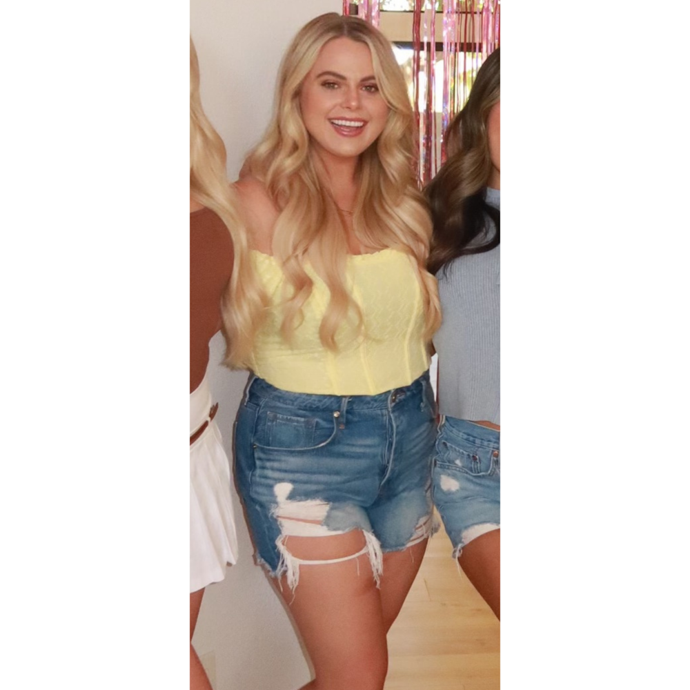 AdmireMD Weight Loss Memberships Before & After Gallery - Patient 175016 - Image 2