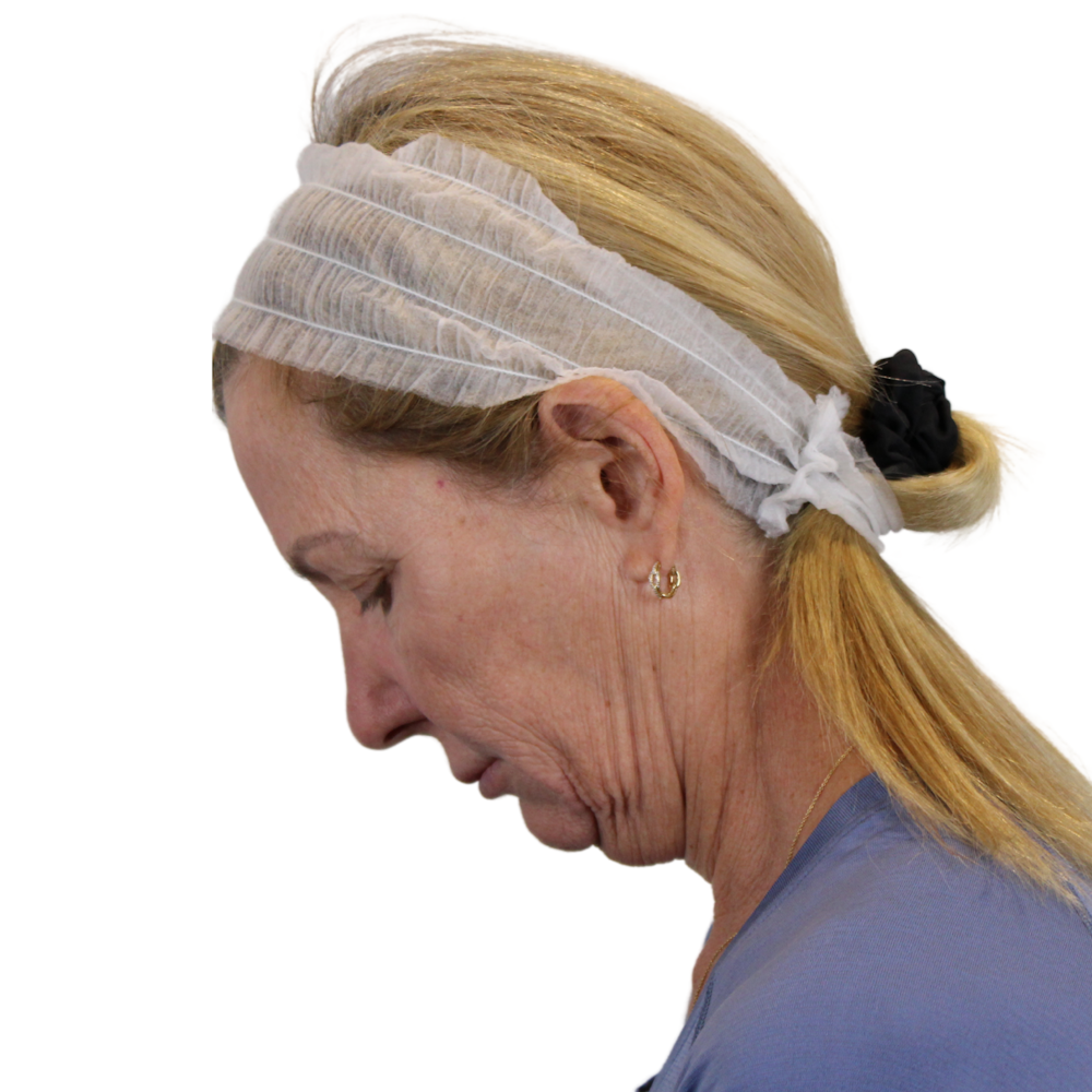 Deep Plane Facelift Before & After Gallery - Patient 207855 - Image 13