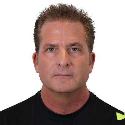 Deep Plane Facelift Before & After Gallery - Patient 308004 - Image 1