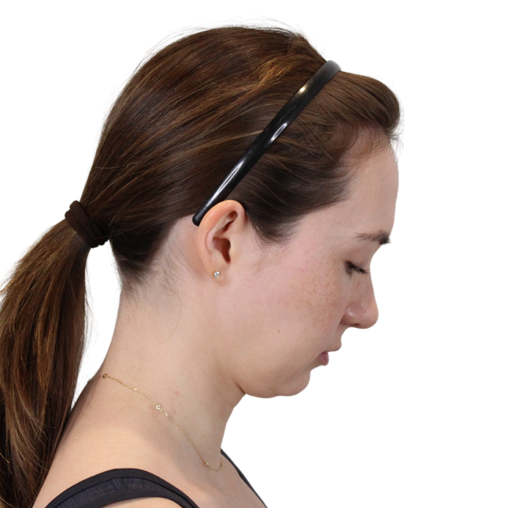 Deep Neck Lift Before & After Gallery - Patient 134891 - Image 7