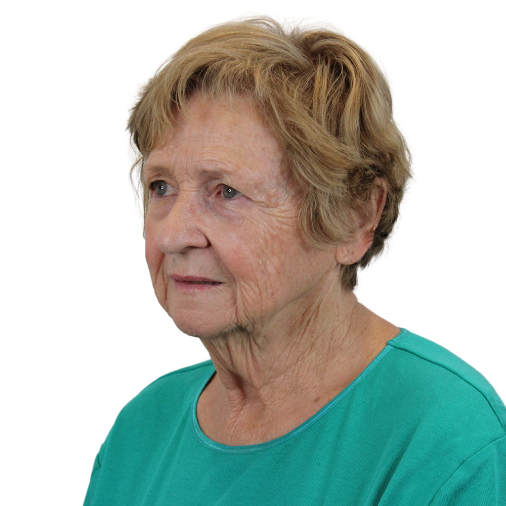 Deep Neck Lift Before & After Gallery - Patient 119730 - Image 5