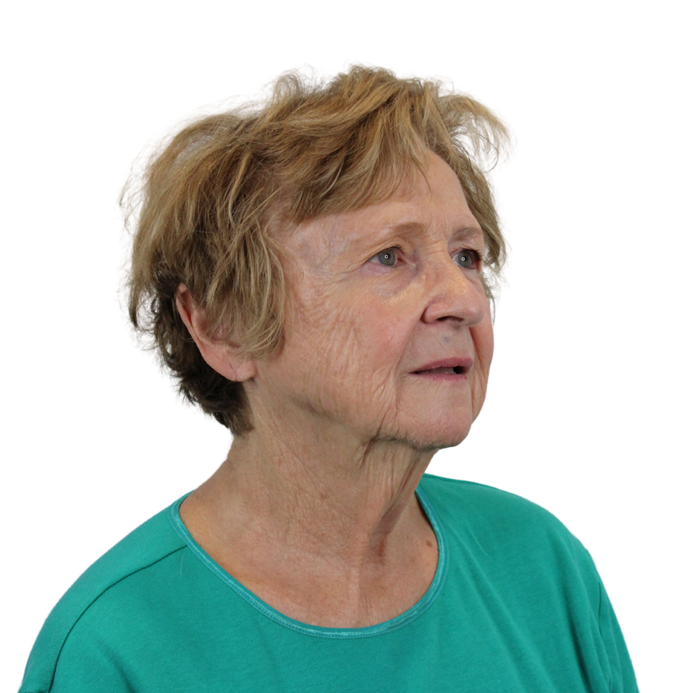 Deep Neck Lift Before & After Gallery - Patient 119730 - Image 3