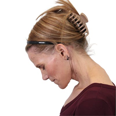 Deep Plane Facelift Before & After Gallery - Patient 131086 - Image 10
