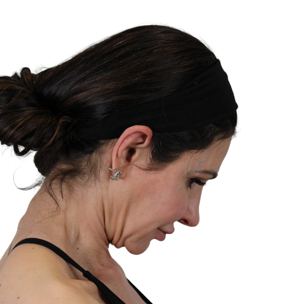Deep Neck Lift Before & After Gallery - Patient 475712 - Image 5