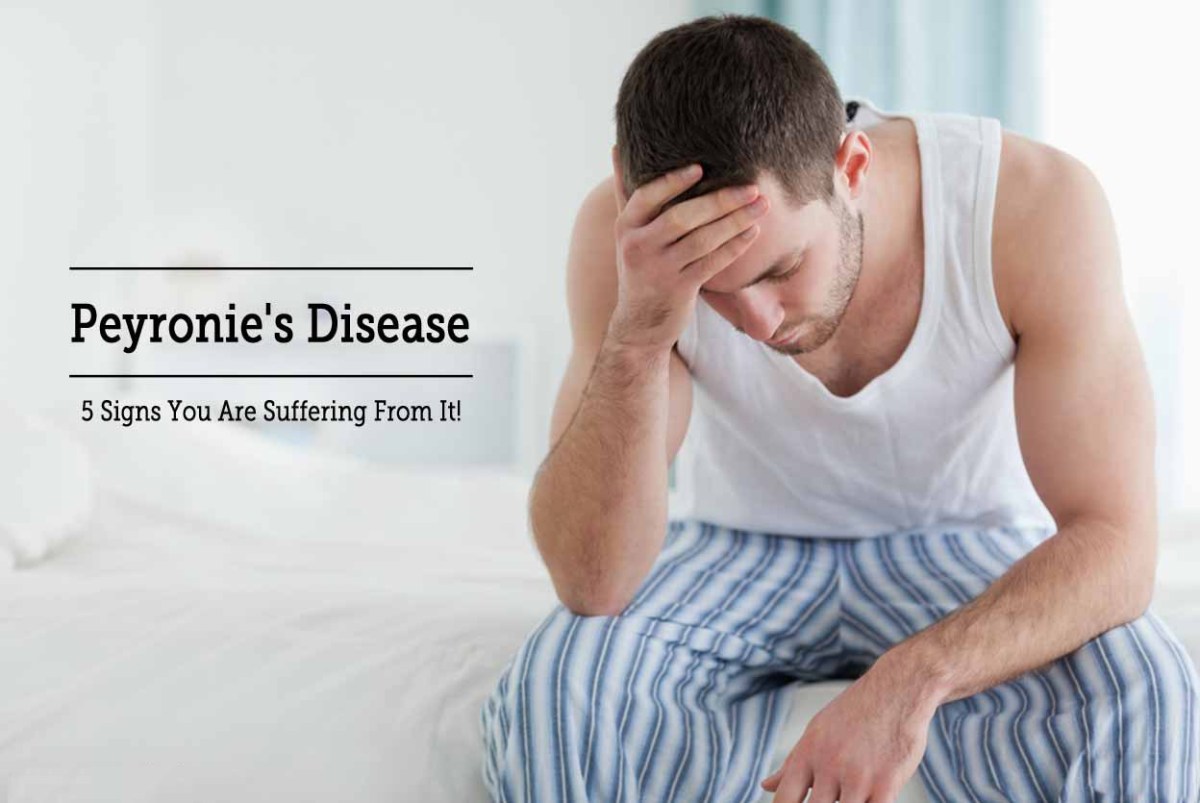 Bay Area Modern Medical Center Blog | Peyronie’s Disease