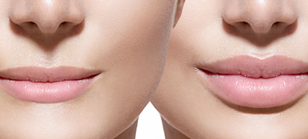 Mangat Copit Plastic Surgery and Skin Care Blog | What Is Lip Enhancement And Is It Right For Me?