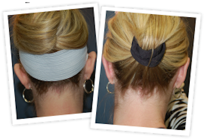 Ear Pinning