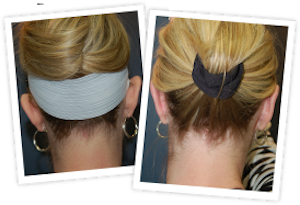 Ear Pinning