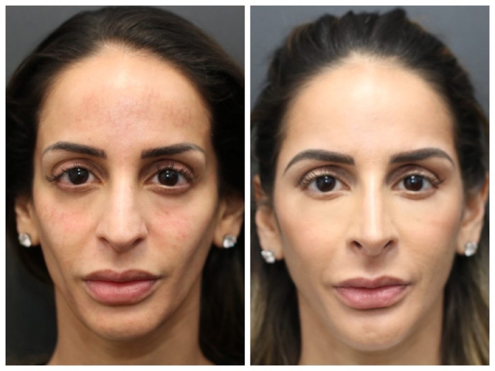 Aesthetic Facial Balancing