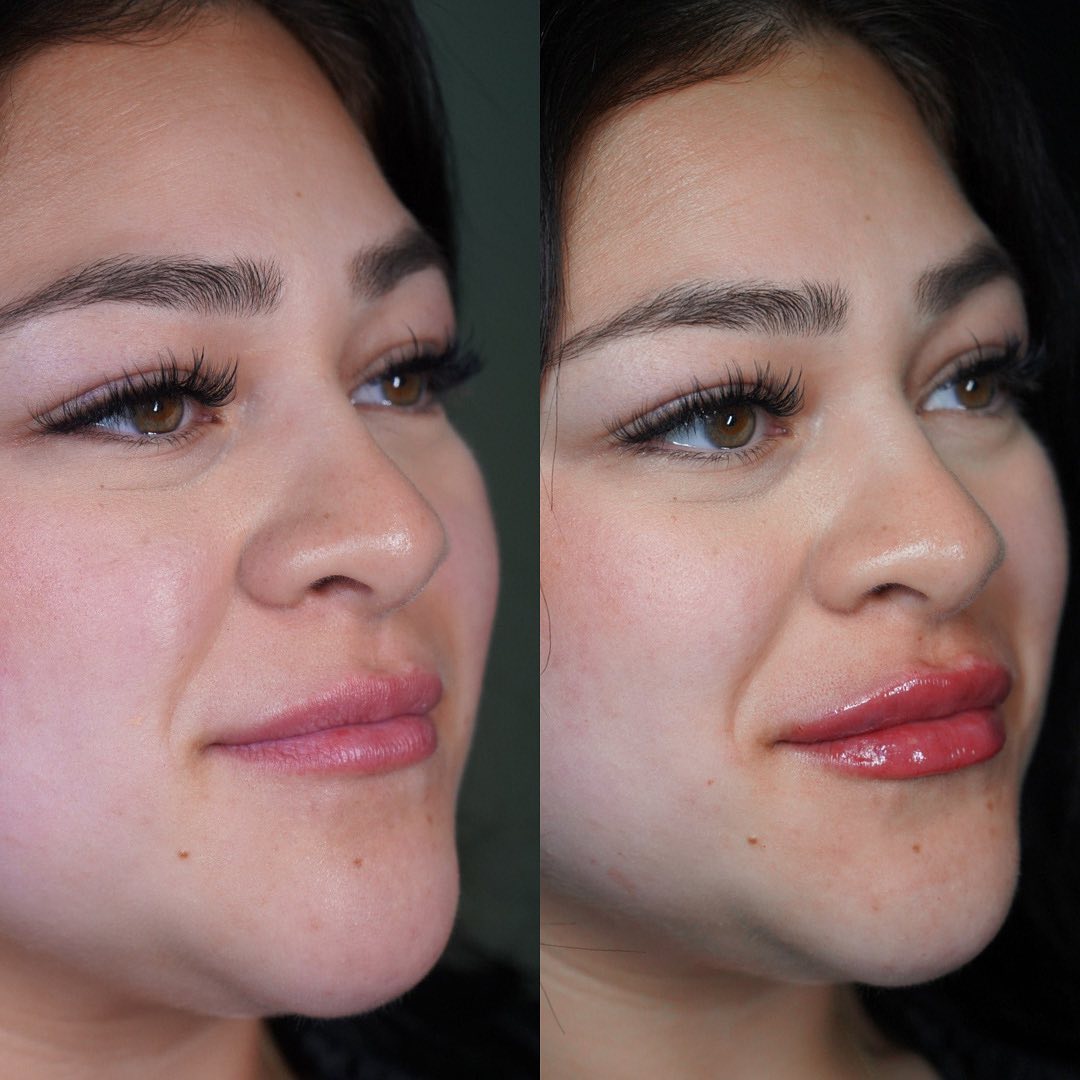 The 8 Point Lift | Facial Balancing by Dr. Courtney