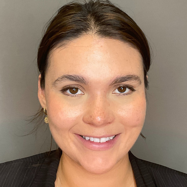 BOTOX Before & After Gallery - Patient 186322 - Image 5