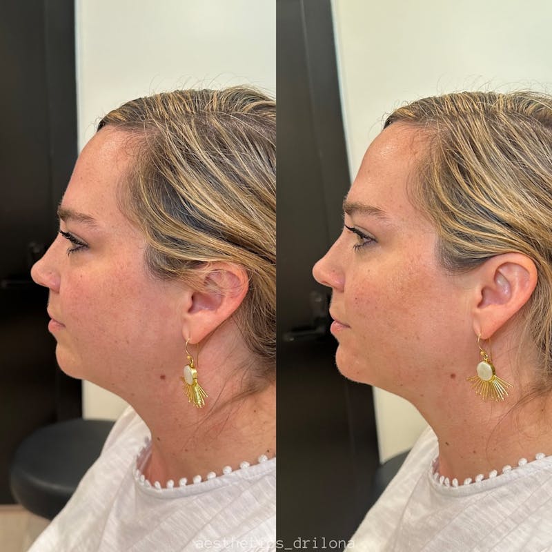 Dr. Courtney Plastic Surgery